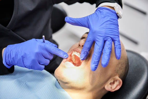 Best Root Canal Emergency Dentist  in Longview Heights, WA