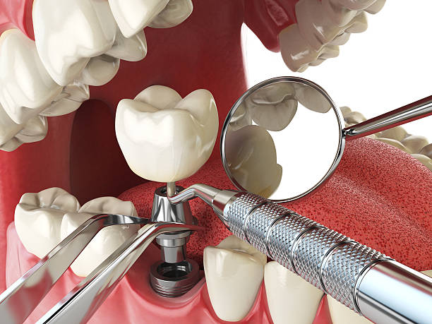 Best Broken Tooth Emergency  in Longview Heights, WA